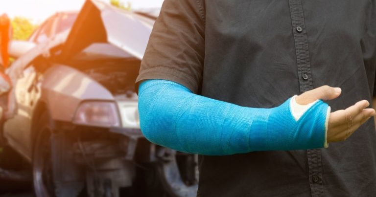 What Are Common Bone Fractures Caused by Car Accidents?